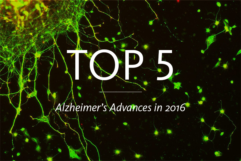 What are the most notable advancements in biotechnology for alzheimer's patients?