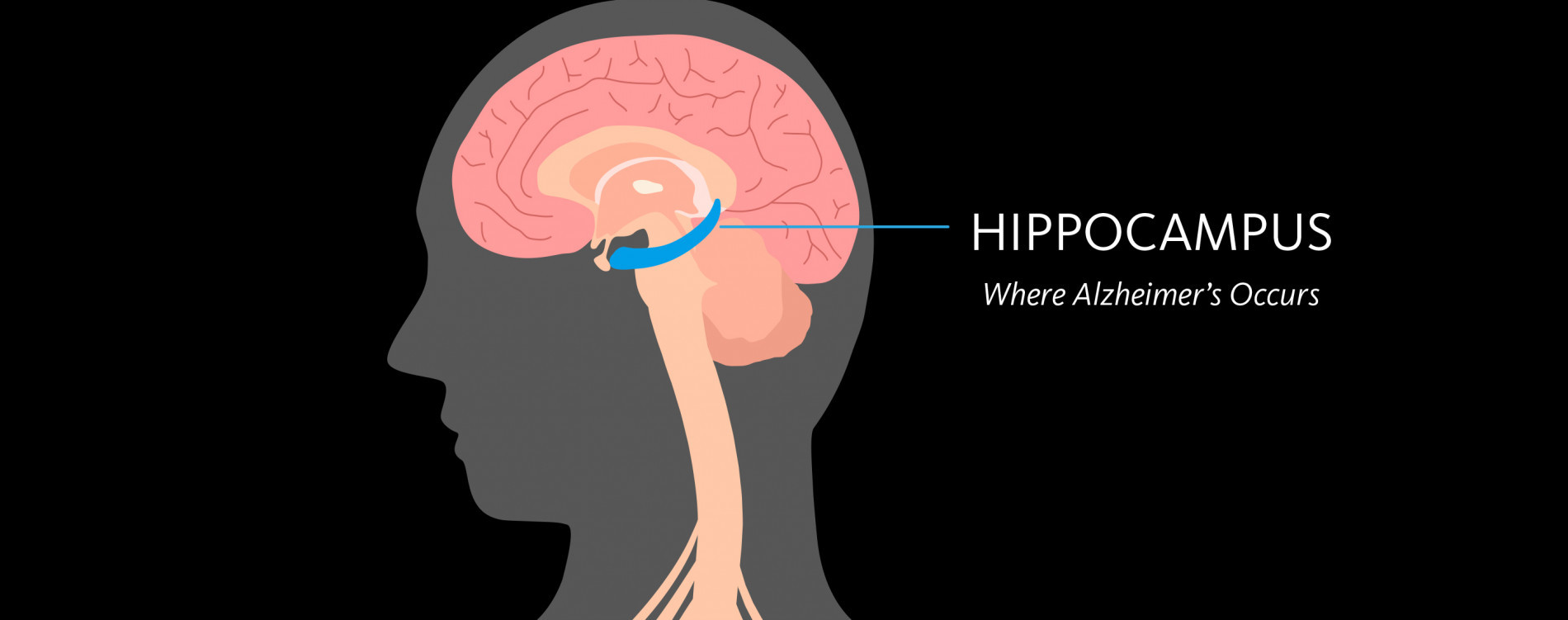 Neurons in the hippocampus