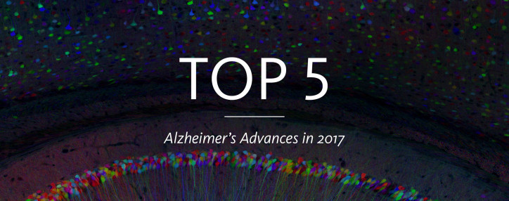 Top 5 Alzheimer's Advances in 2017