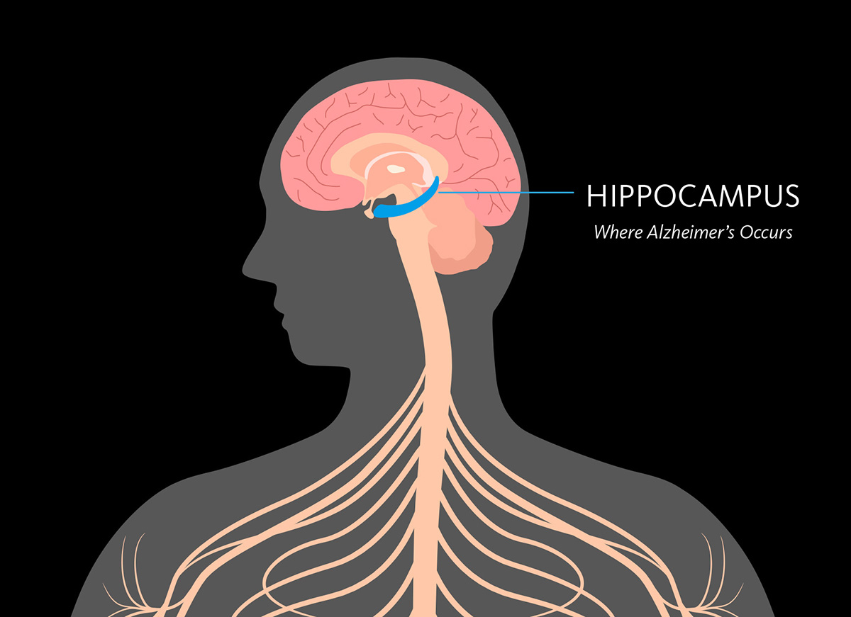 Neurons in the hippocampus