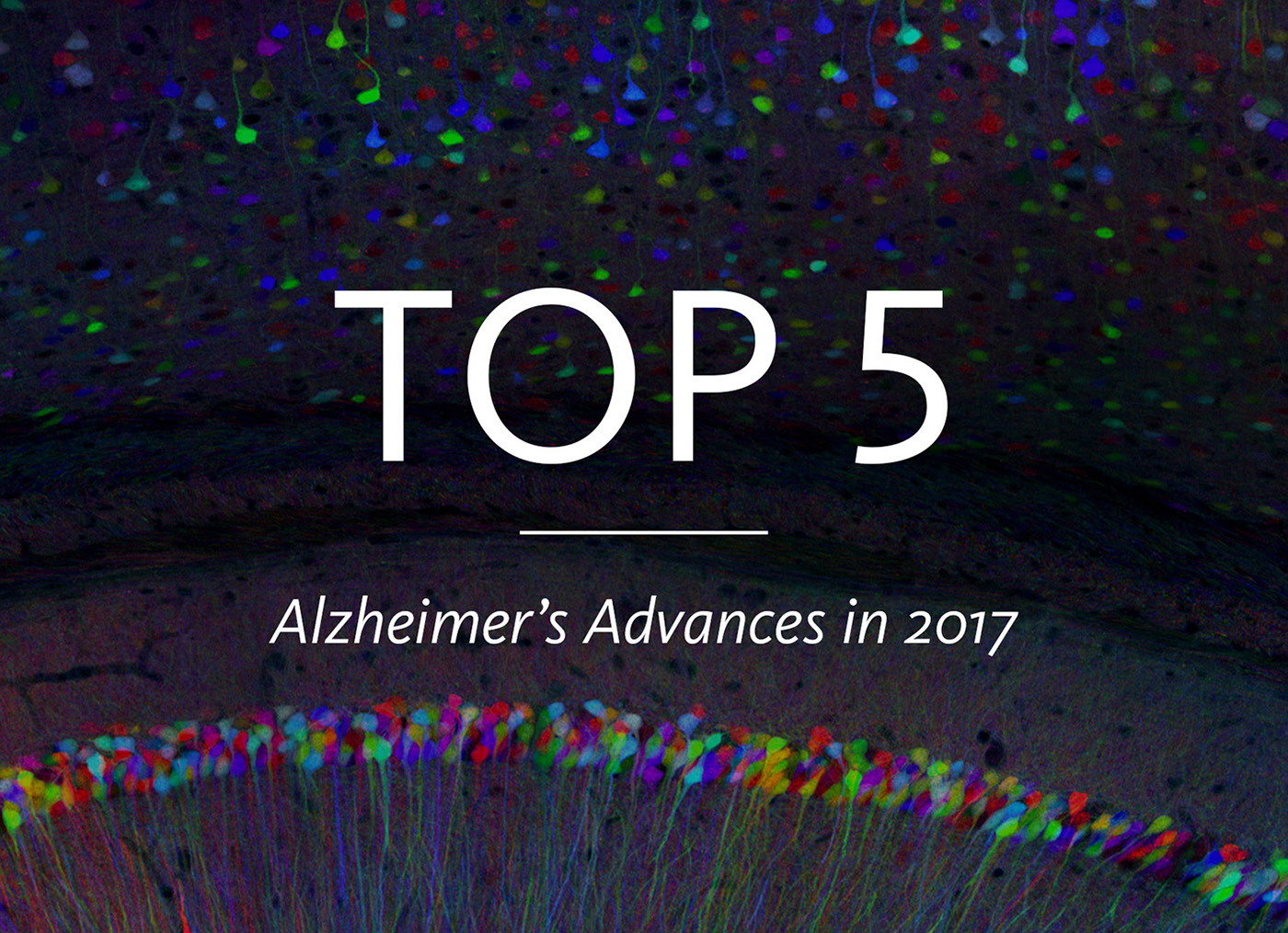 Top 5 Alzheimer's Advances in 2017